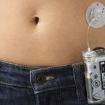 Insulin Pump